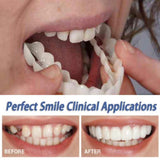 Cosmetic Dentistry Snap On Smile Instant Perfect Smile Teeth One Size Fits Most Comfortable Denture Care