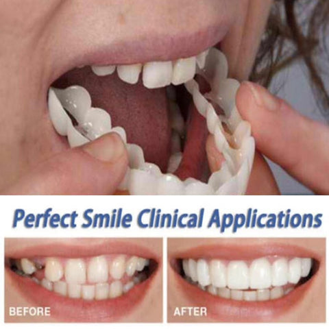 Cosmetic Dentistry Snap On Smile Instant Perfect Smile Teeth One Size Fits Most Comfortable Denture Care