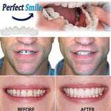 Cosmetic Dentistry Snap On Smile Instant Perfect Smile Teeth One Size Fits Most Comfortable Denture Care