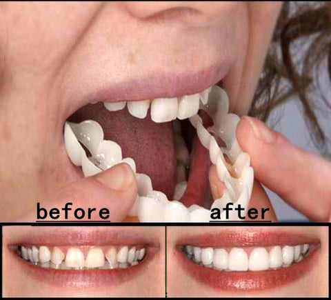 Cosmetic Dentistry Snap On Smile Instant Perfect Teeth Fits