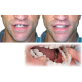 2018 New Cosmetic Dentistry Snap On Smile Instant Smile Comfort Fit